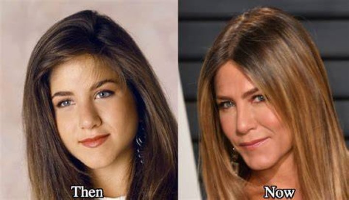 Jennifer Aniston Nose Job And Plastic Surgery Before And After Photos