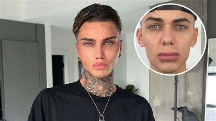 Levi Jed Murphy Before Plastic Surgery He Didn't Resemble Handsome