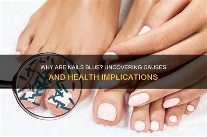 Uncovering The Causes And Implications