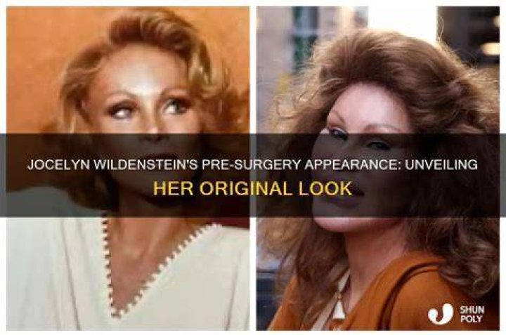 Unveiling The Enigmatic Jocelyn Wildenstein: Uncovering Secrets And Surprises
